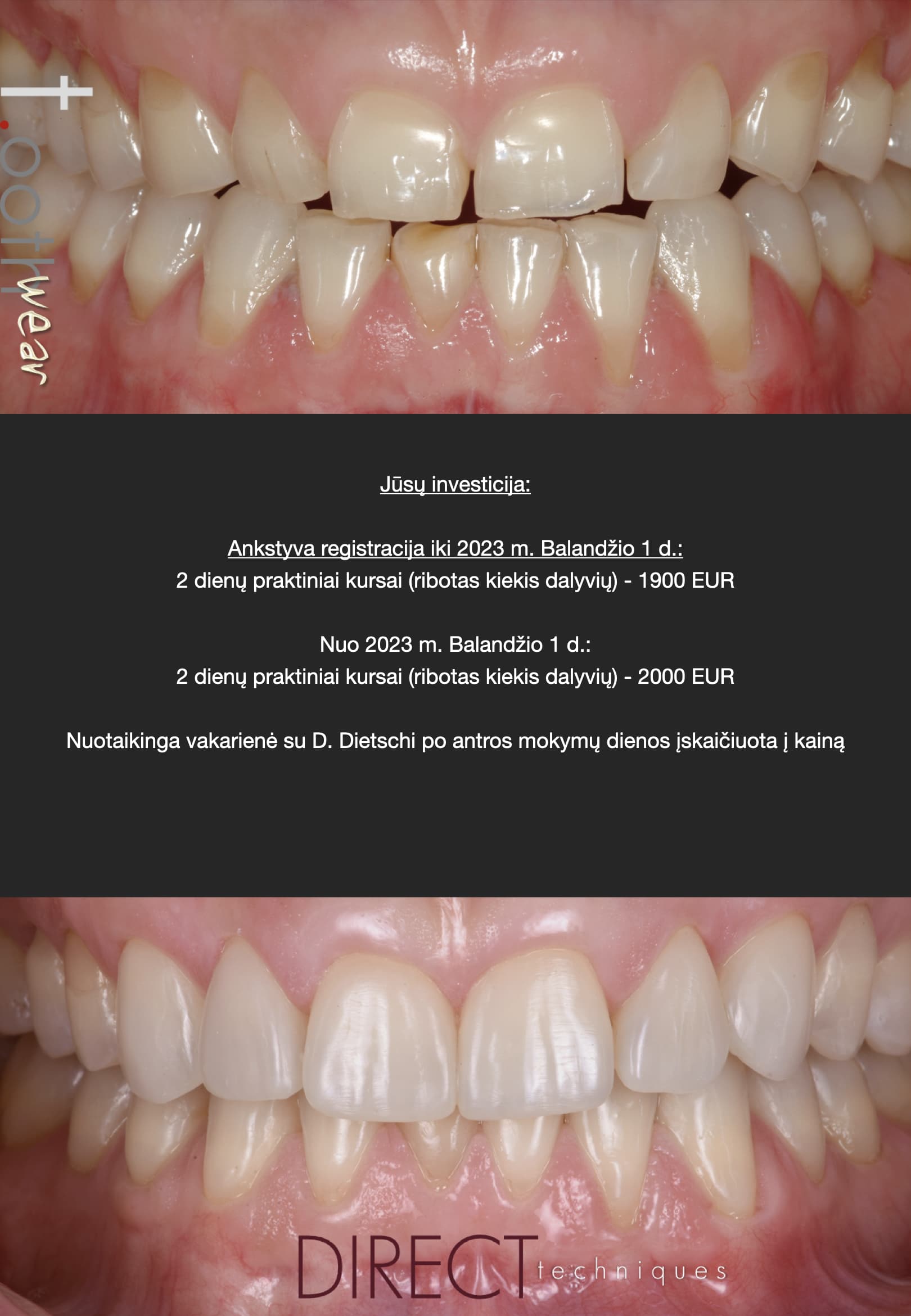 tooth-wear-vilnius-2023-program-a4-003.jpeg?105f4f2e741be0203e1ac671b77c6b24