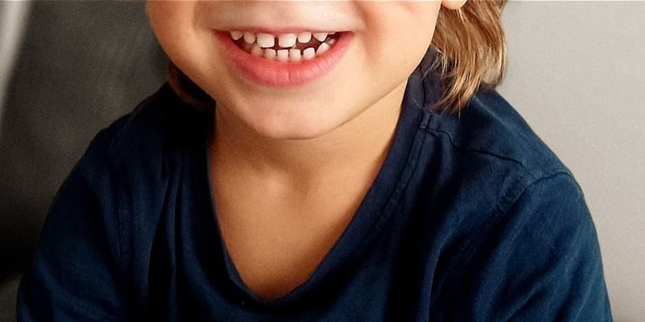 Vaikų burnos sveikata ir ligų profilaktika. Misija įmanoma.