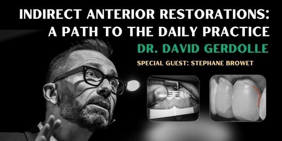 Indirect anterior restorations: a path to the daily practice with David Gerdolle & Stephane Browet