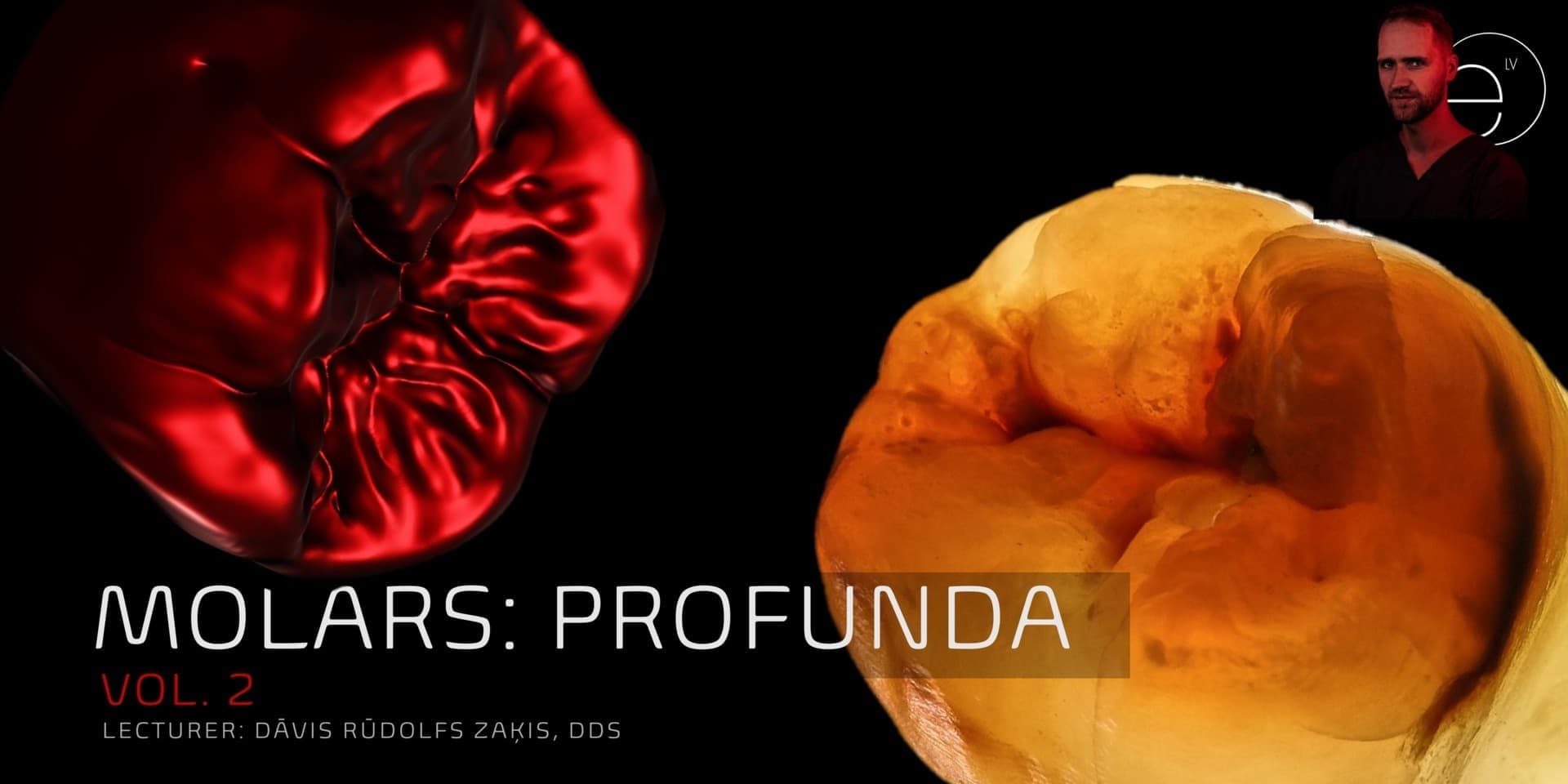 MOLARS: PART II - PROFUNDA